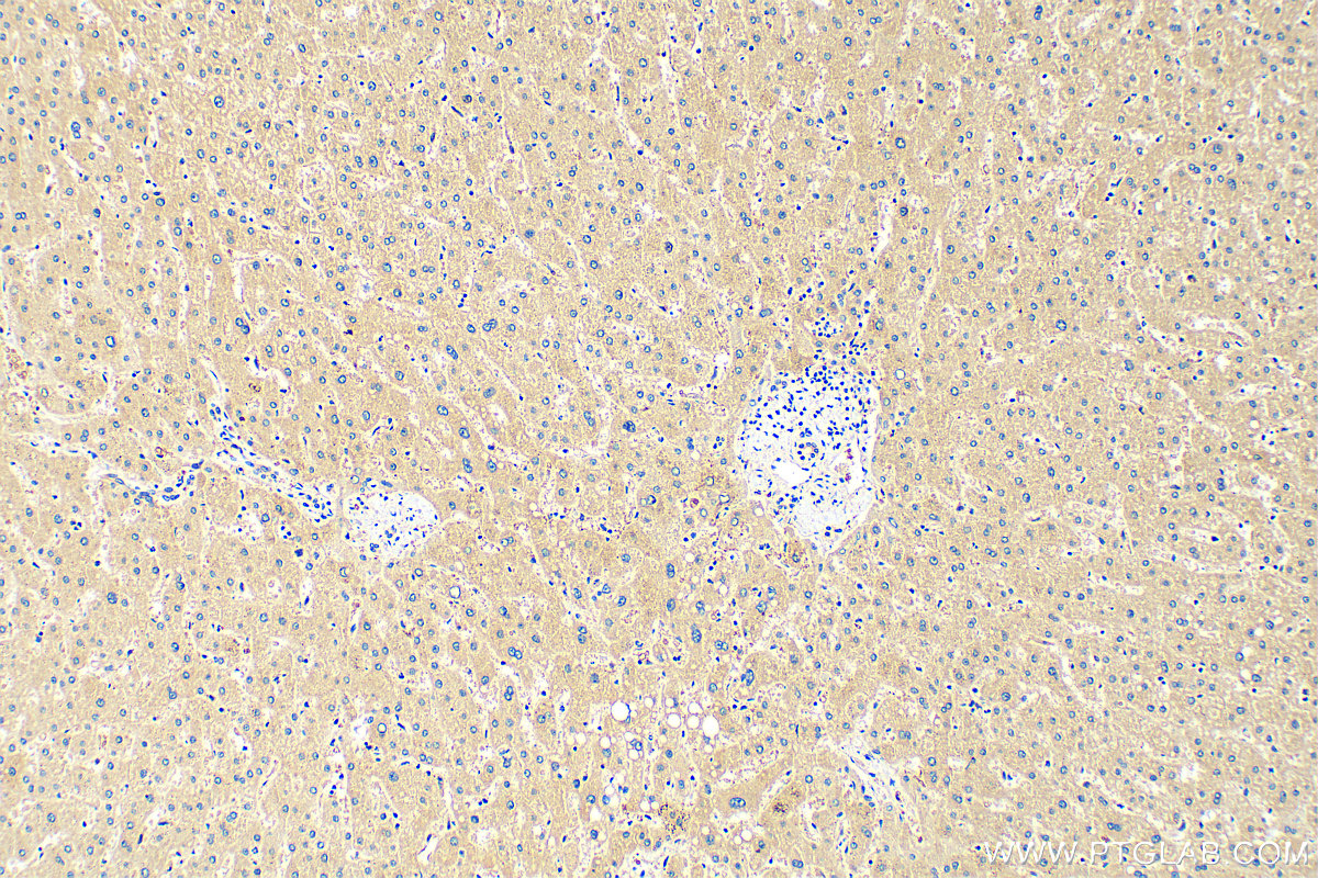 IHC staining of human liver using 30977-1-AP