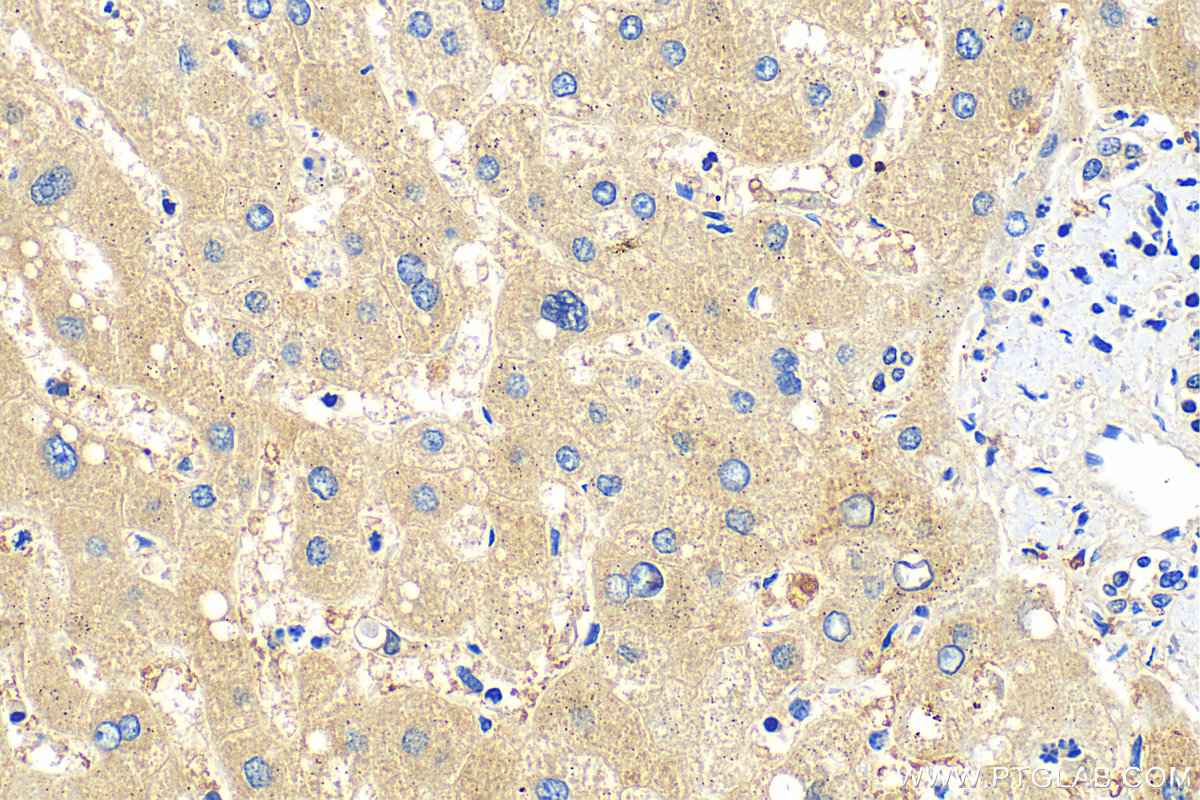IHC staining of human liver using 30977-1-AP