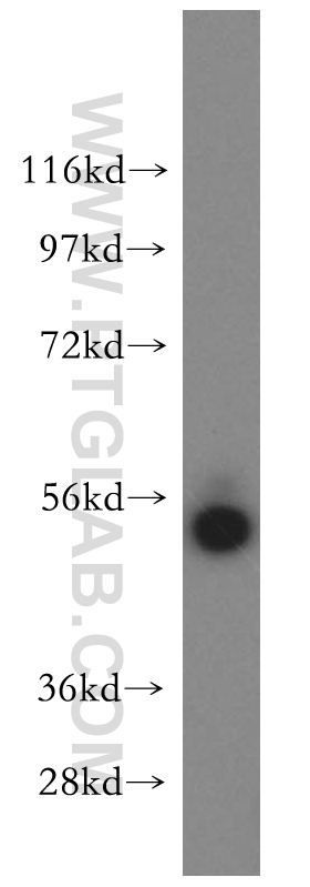 WB analysis of mouse kidney using 16861-1-AP