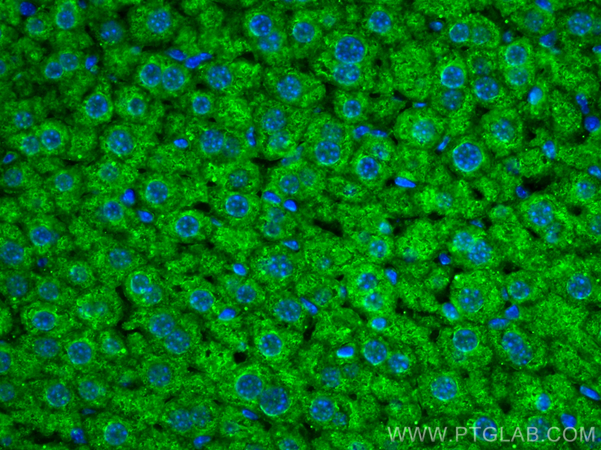 IF Staining of mouse liver using 67881-1-Ig (same clone as 67881-1-PBS)
