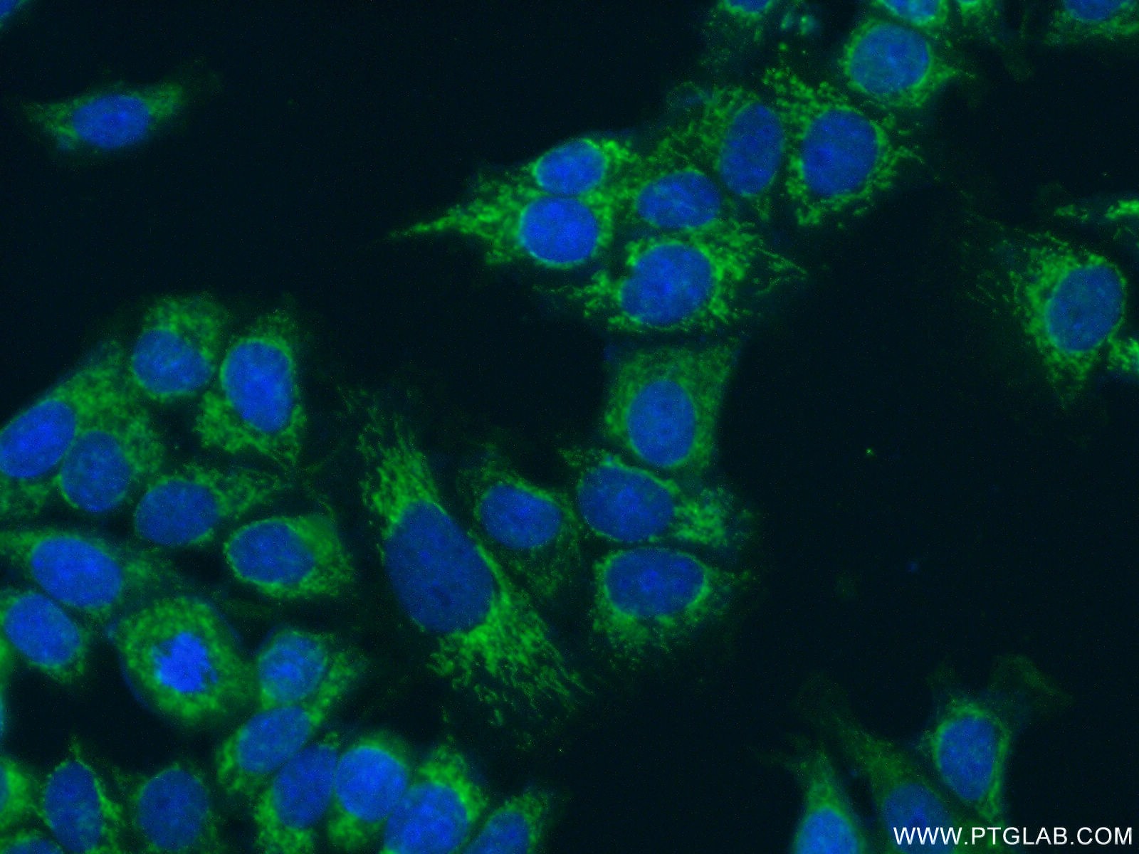 IF Staining of MCF-7 using 16864-1-AP