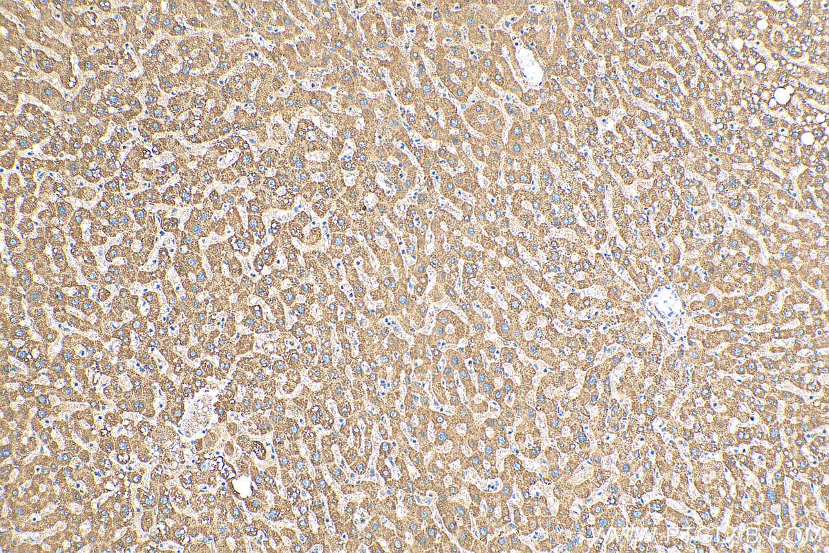 IHC staining of human liver using 16864-1-AP
