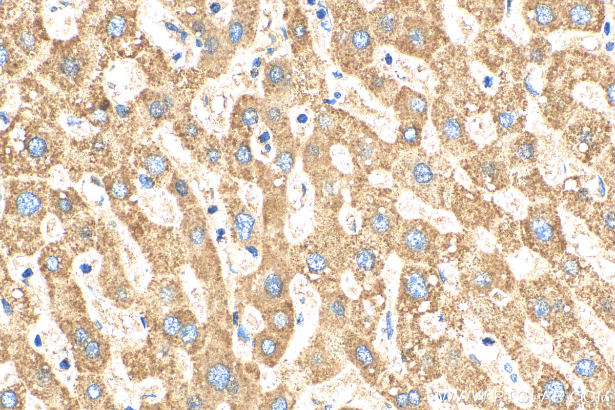 IHC staining of human liver using 16864-1-AP