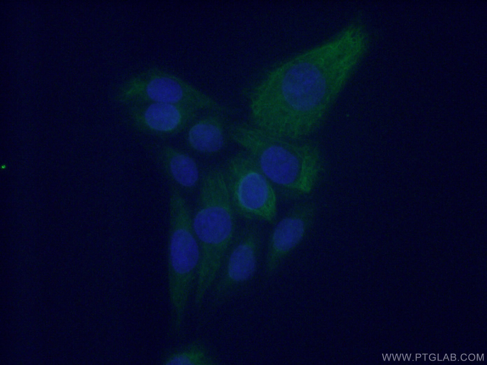IF Staining of HeLa using 13281-1-AP