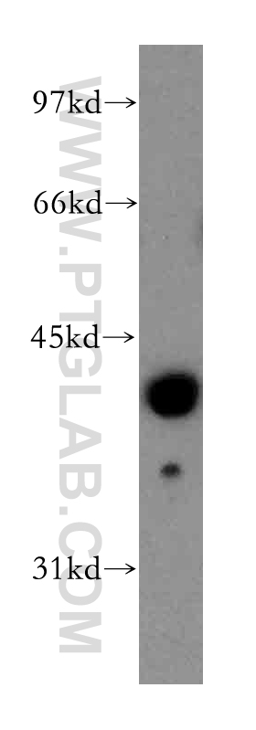 WB analysis of human liver using 13281-1-AP