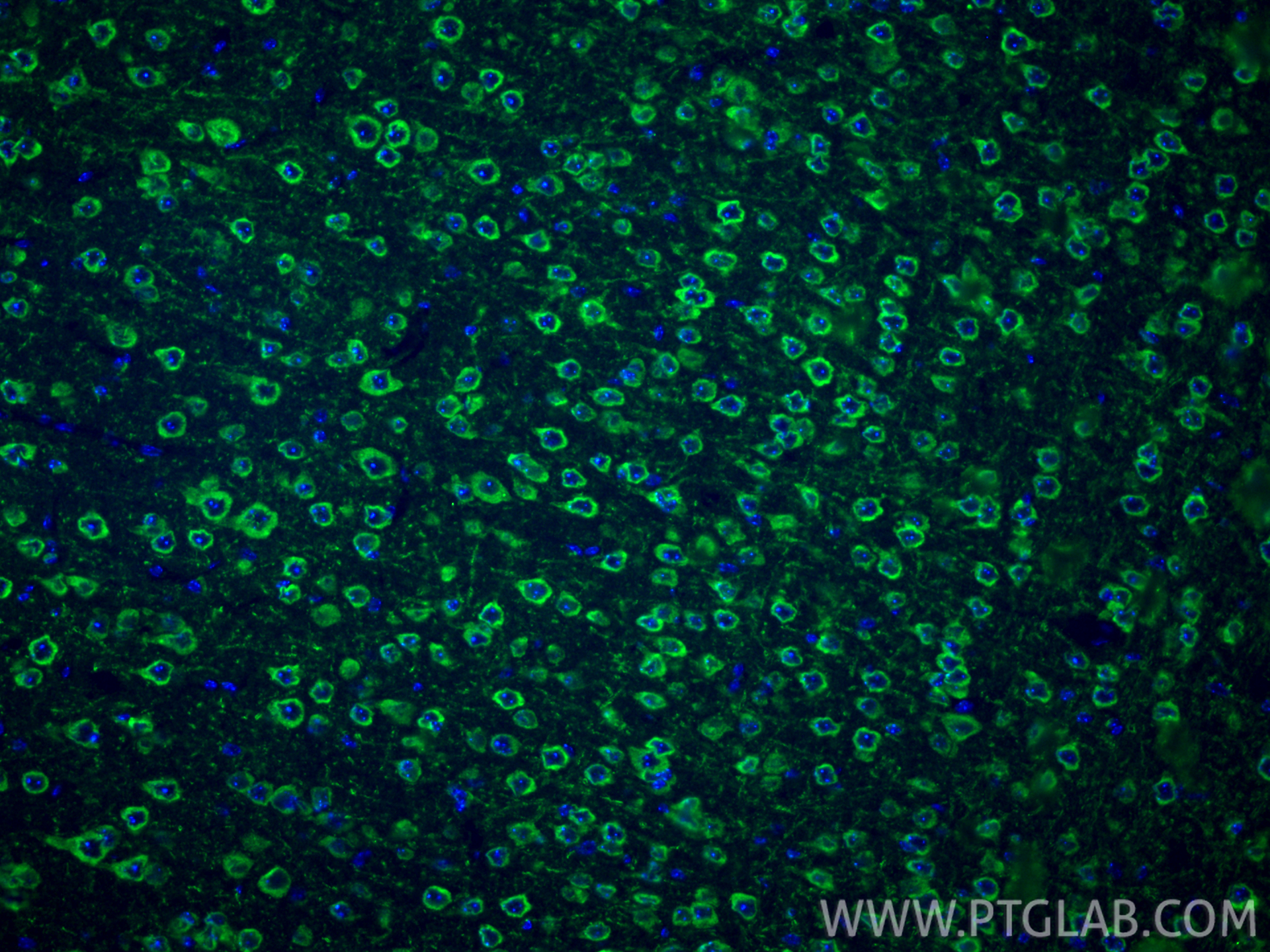 IF Staining of mouse brain using 13755-1-AP