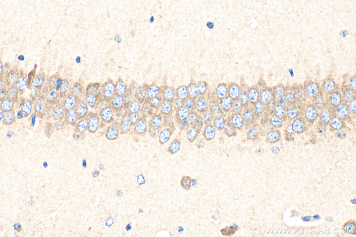 Immunohistochemical analysis of paraffin-embedded mouse brain tissue slide using 13755-1-AP (FMR1 antibody) at dilution of 1:400 (under 40x lens). Heat mediated antigen retrieval with Tris-EDTA buffer (pH 9.0). IHC staining of mouse brain using 13755-1-AP