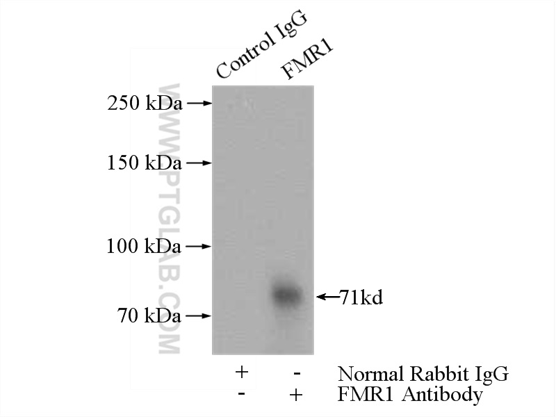 IP experiment of HeLa using 13755-1-AP