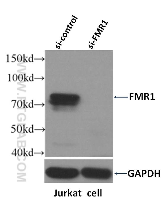 WB analysis of Jurkat cells using 13755-1-AP