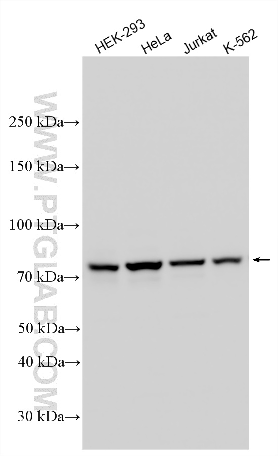 WB analysis using 13755-1-AP