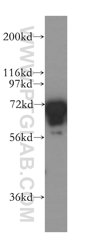 WB analysis of K-562 using 13755-1-AP