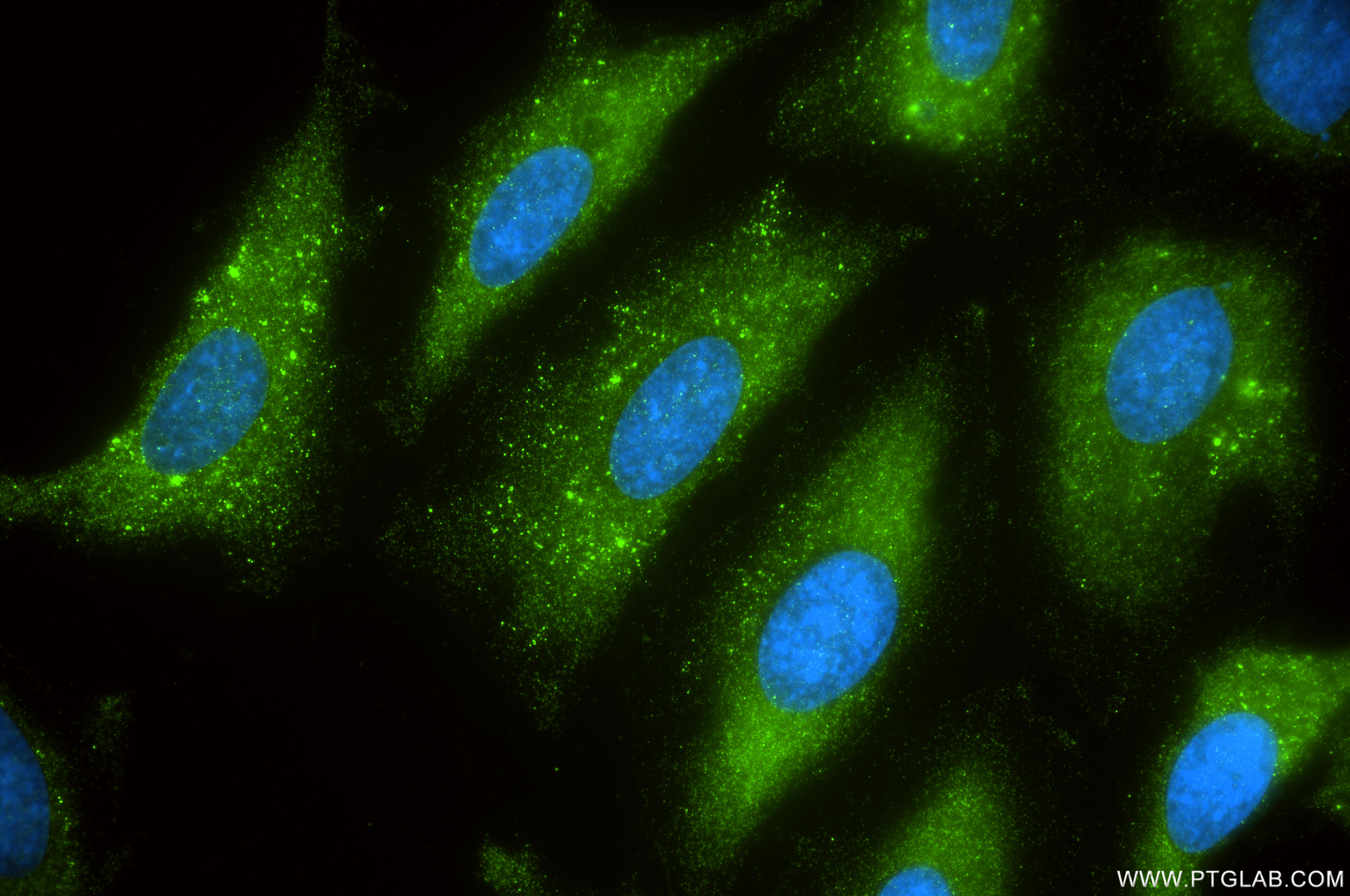 IF Staining of HeLa using 87803-1-RR IF Staining of HeLa using 87803-1-RR