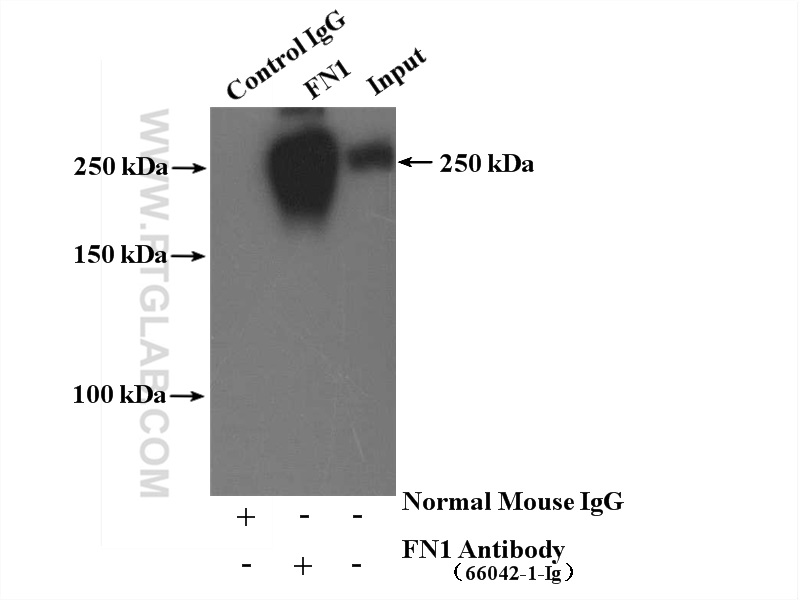 IP experiment of human plasma using 66042-1-Ig