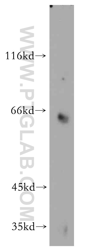 WB analysis of mouse brain using 55055-1-AP