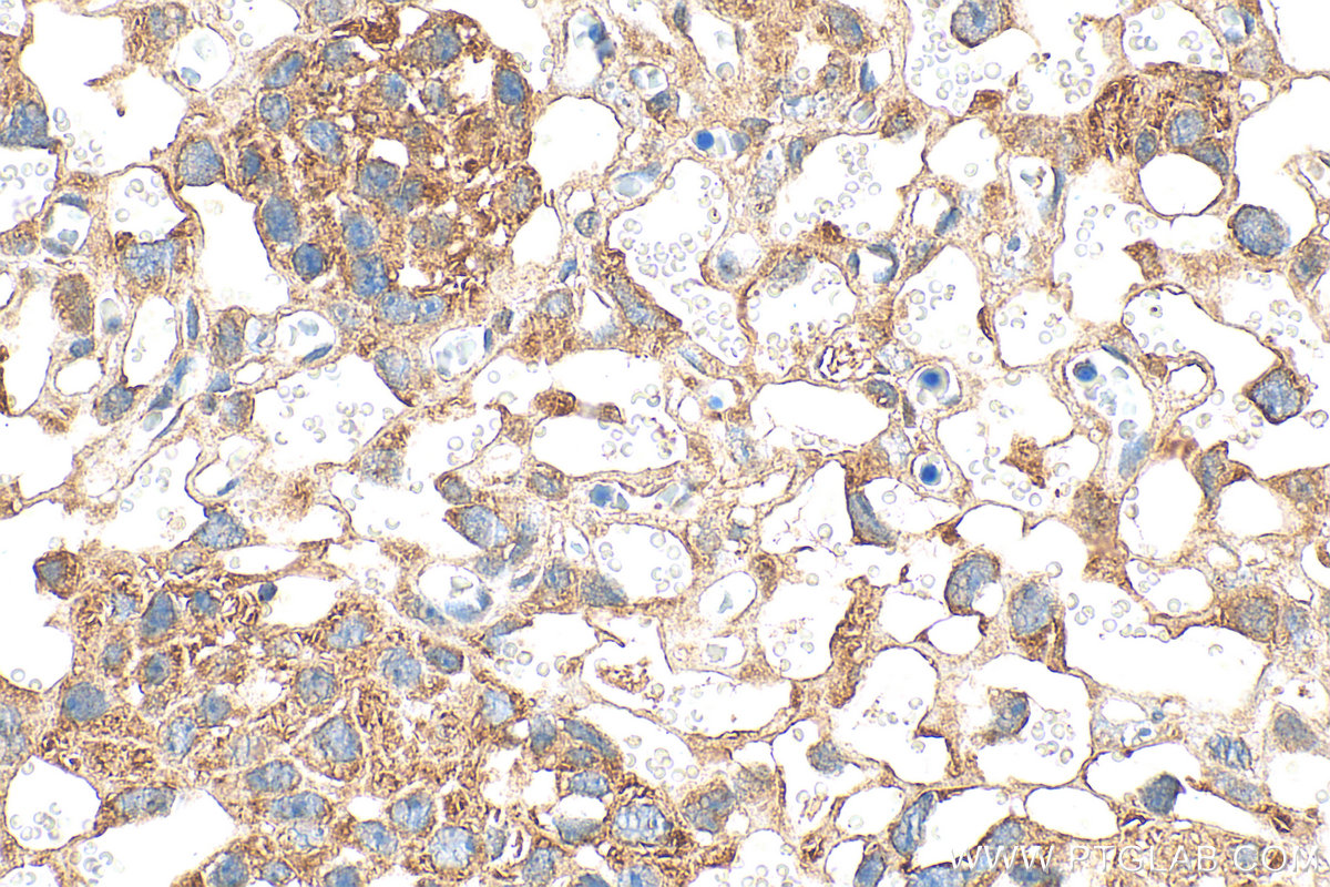 IHC staining of mouse placenta using 25240-1-AP