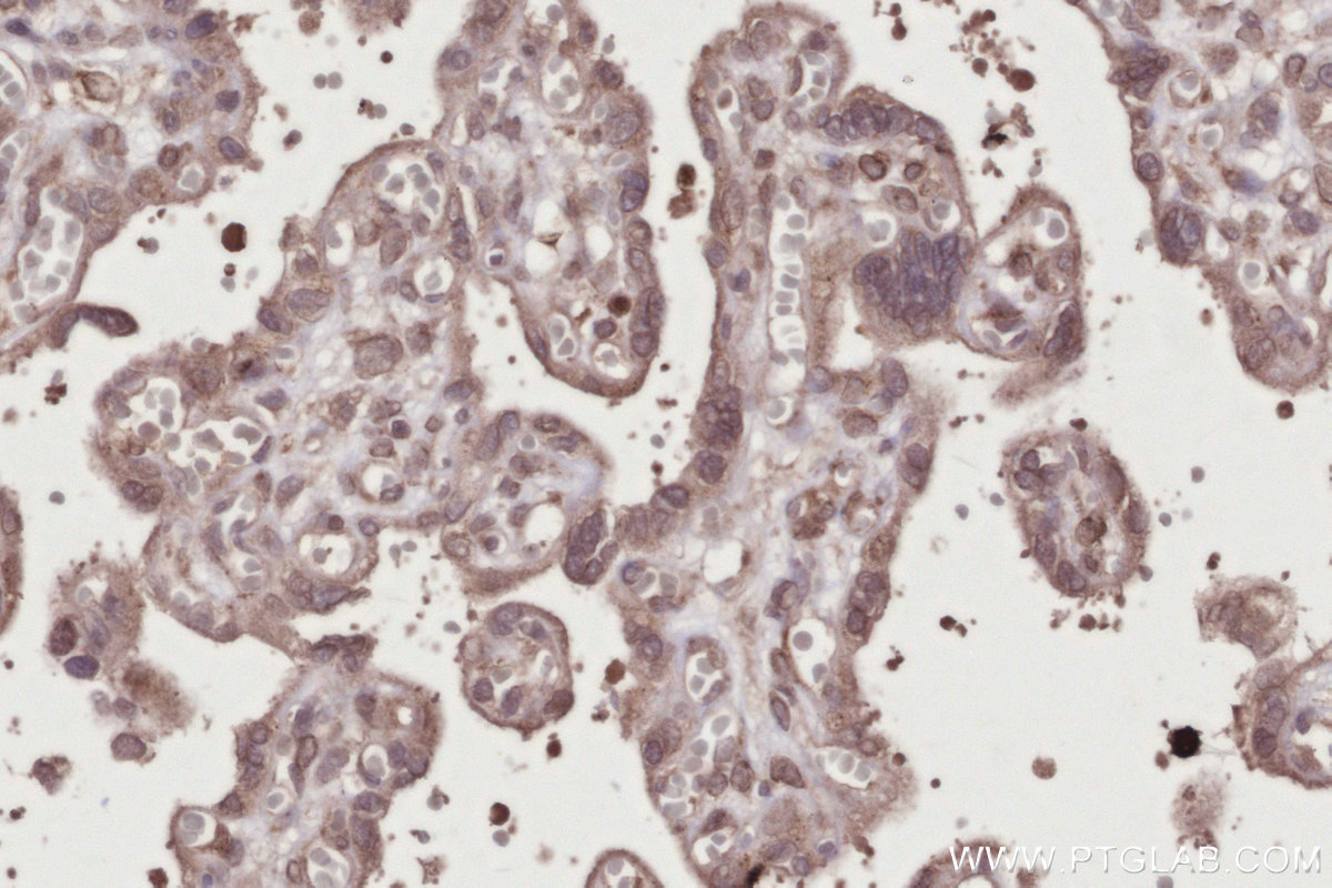 IHC staining of human placenta using 28380-1-AP IHC staining of human placenta using 28380-1-AP