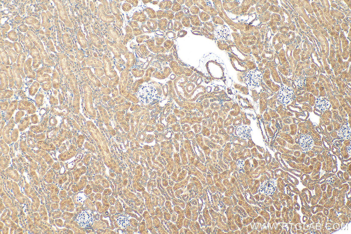 IHC staining of mouse kidney using 31283-1-AP