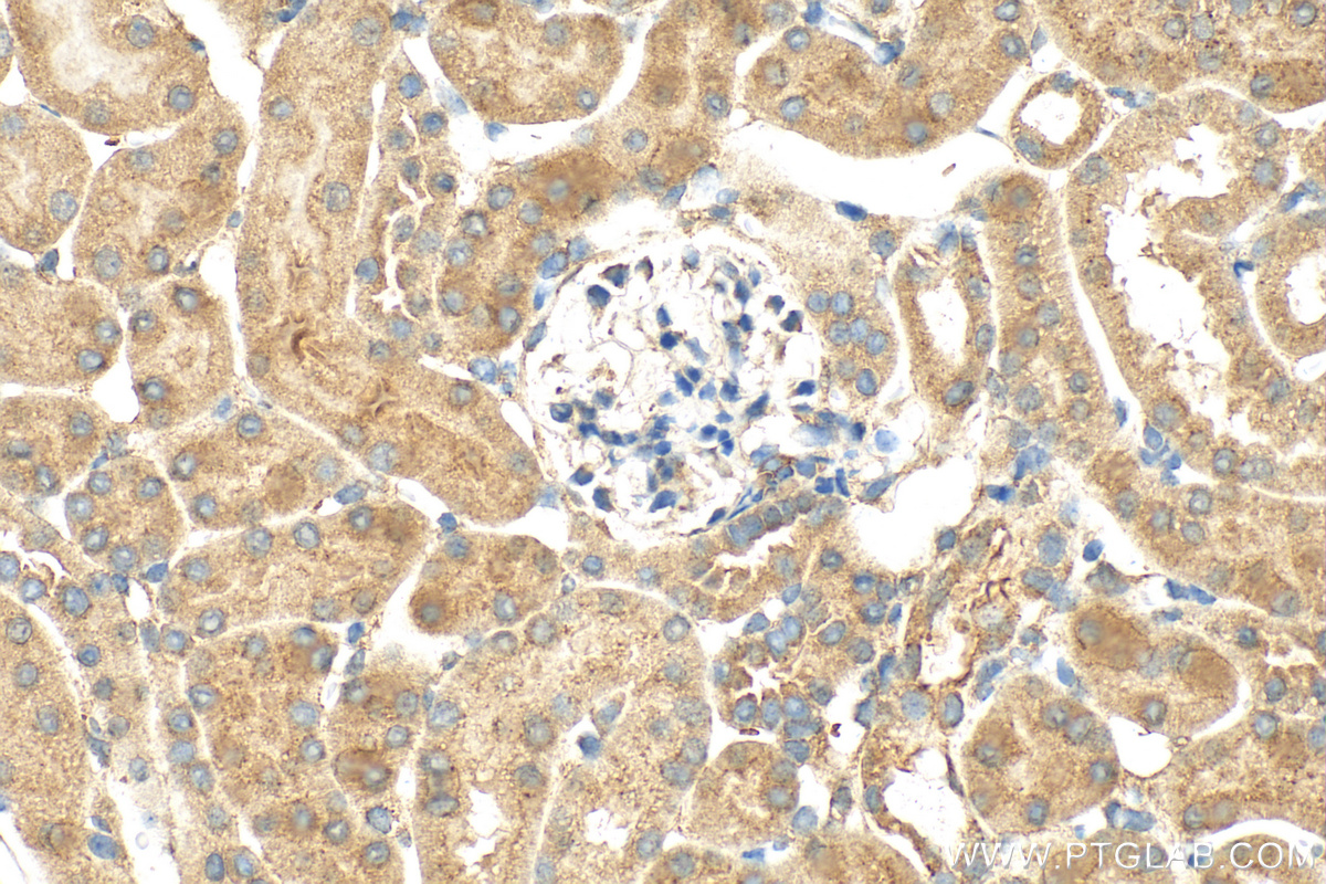 IHC staining of mouse kidney using 31283-1-AP