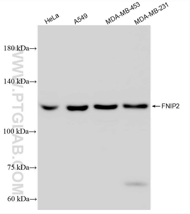 WB analysis using 84371-2-RR WB analysis using 84371-2-RR