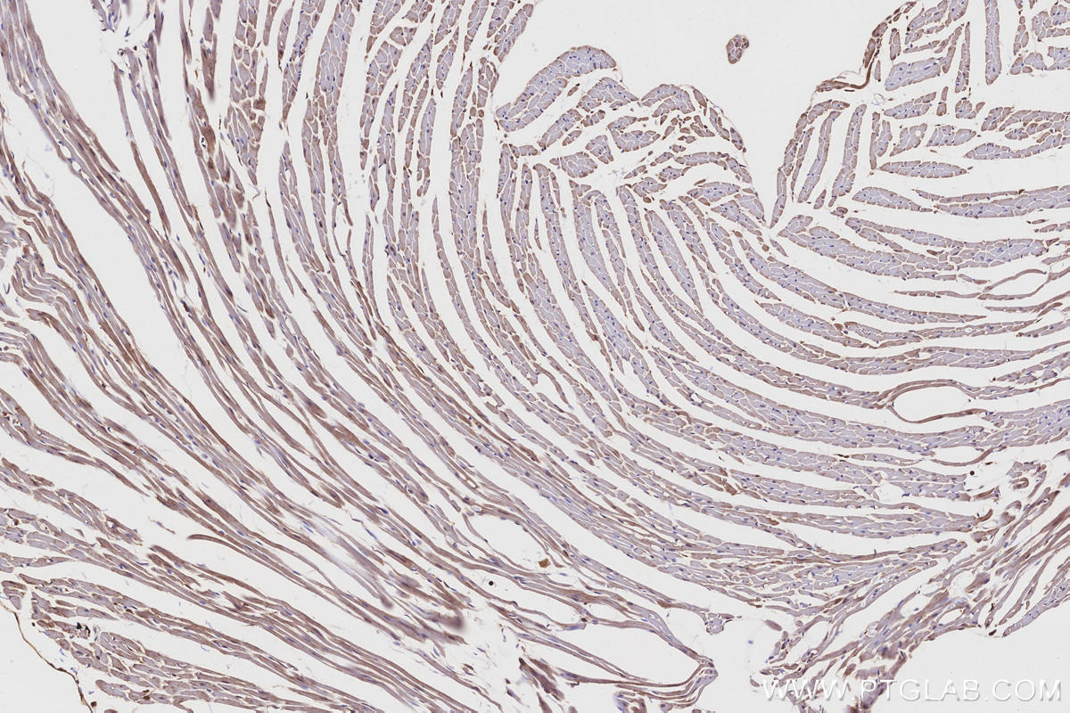 IHC staining of mouse heart using 12274-1-AP IHC staining of mouse heart using 12274-1-AP