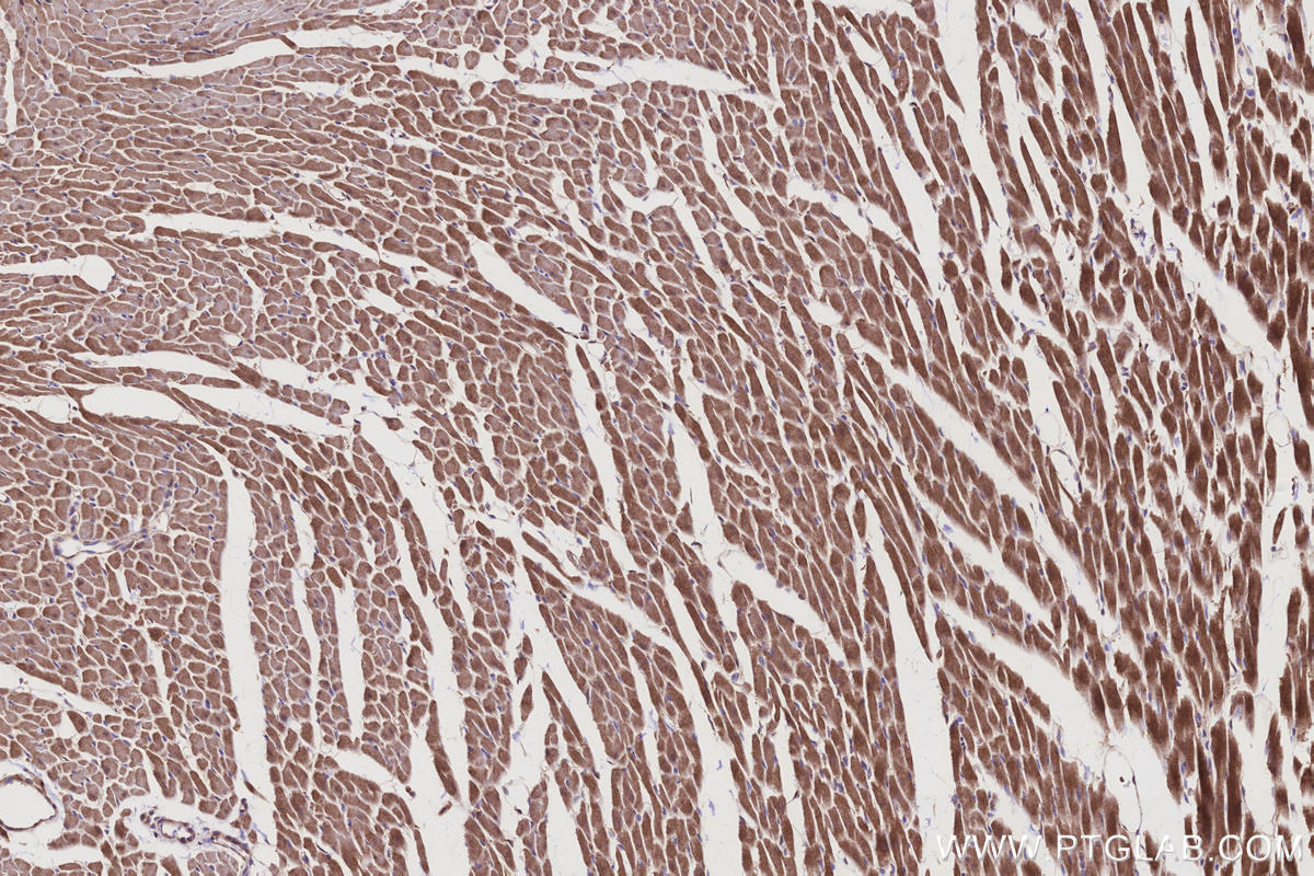 IHC staining of rat heart using 12274-1-AP IHC staining of rat heart using 12274-1-AP