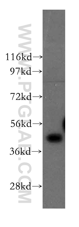 FNTA Polyclonal antibody