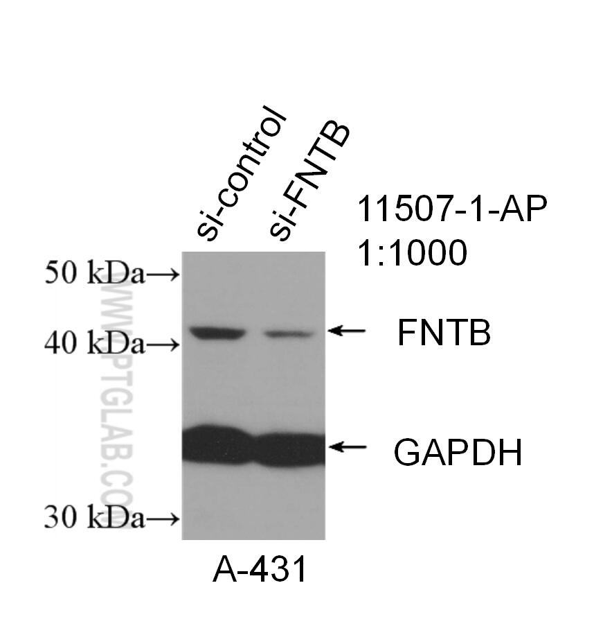 WB analysis of A431 using 11507-1-AP