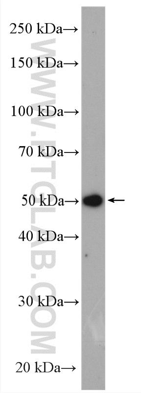 WB analysis of mouse heart using 11507-1-AP