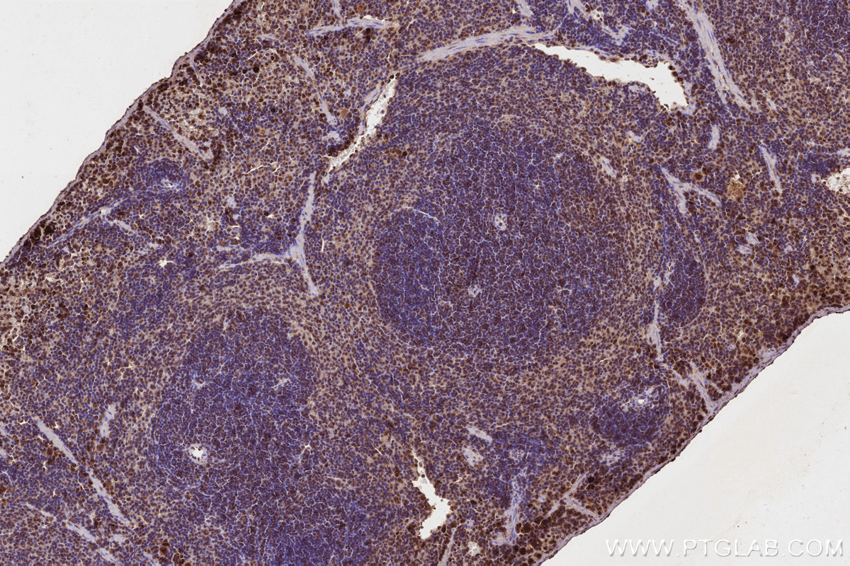 IHC staining of mouse spleen using 66783-1-Ig IHC staining of mouse spleen using 66783-1-Ig