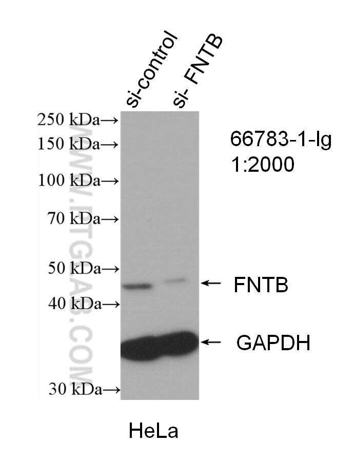 WB analysis of HeLa using 66783-1-Ig