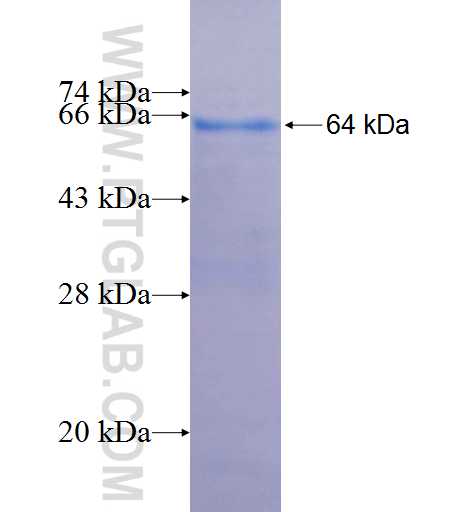 FNTB fusion protein Ag2061 SDS-PAGE