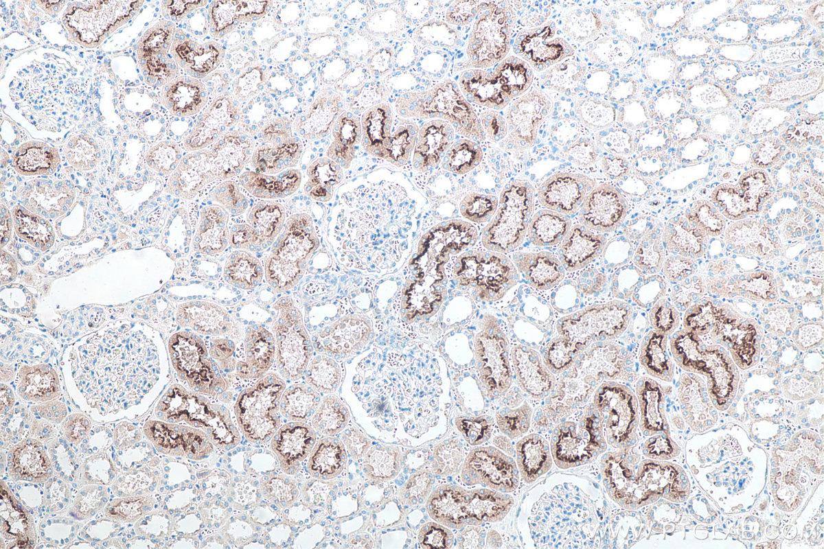 IHC staining of human kidney using 66678-1-Ig IHC staining of human kidney using 66678-1-Ig