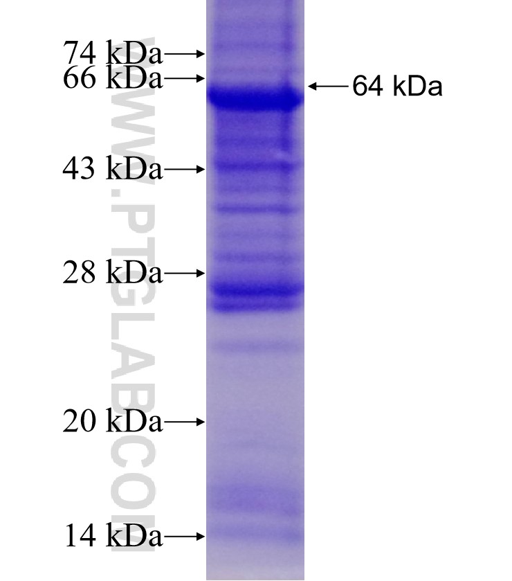 FOLH1 fusion protein Ag3812 SDS-PAGE