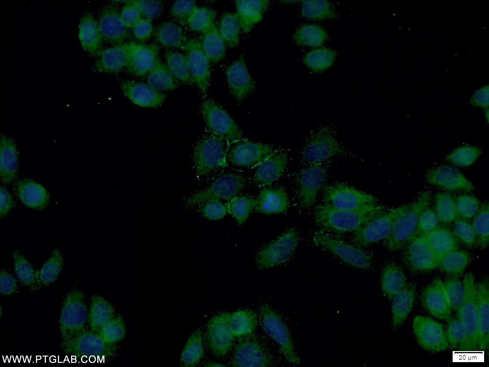 IF Staining of HeLa using 23355-1-AP