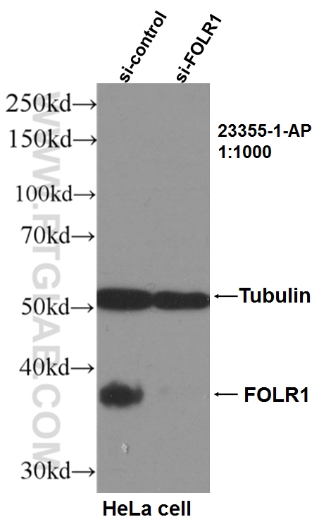 WB analysis of HeLa using 23355-1-AP