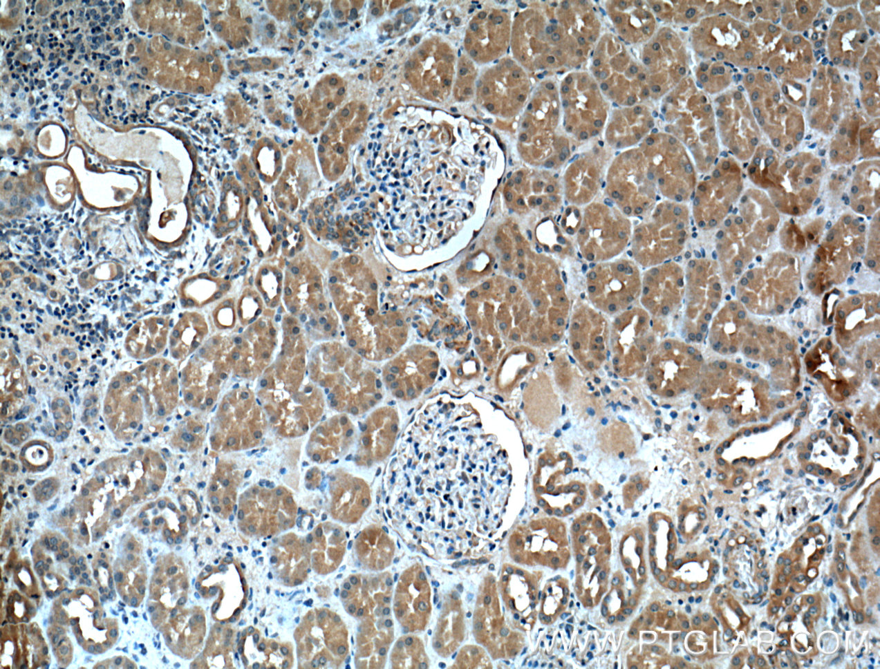 IHC staining of human kidney using 60307-1-Ig