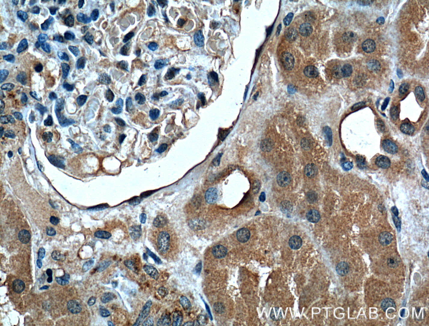 IHC staining of human kidney using 60307-1-Ig