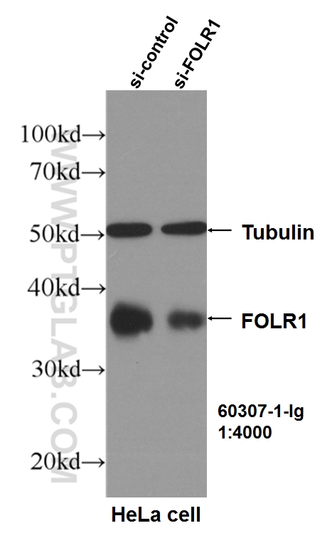 WB analysis of HeLa using 60307-1-Ig (same clone as 60307-1-PBS)