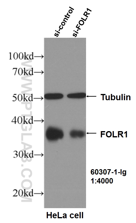 WB analysis of HeLa using 60307-1-Ig