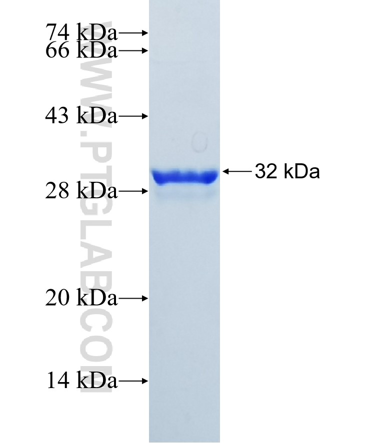 FOLR1 fusion protein Ag19959 SDS-PAGE