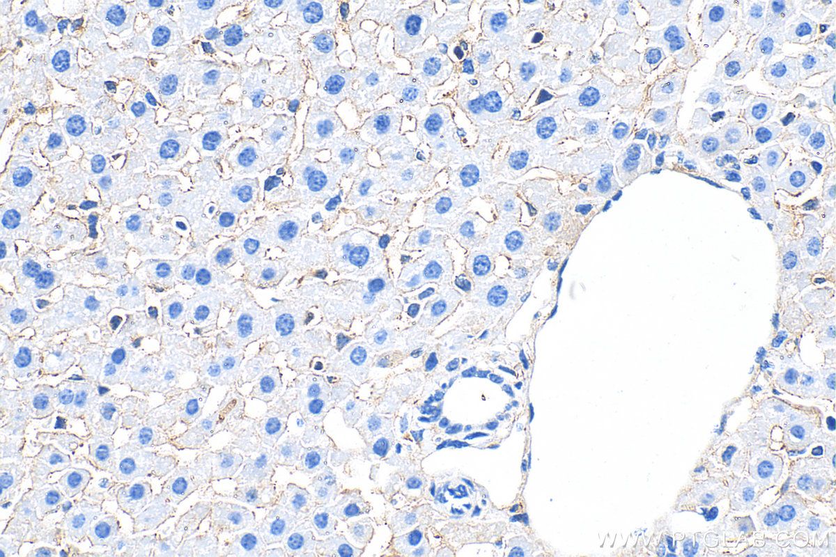 Immunohistochemical analysis of paraffin-embedded mouse liver tissue slide using 31264-1-AP (FOLR2 antibody) at dilution of 1:400 (under 40x lens). Heat mediated antigen retrieval with Tris-EDTA buffer (pH 9.0). IHC staining of mouse liver using 31264-1-AP