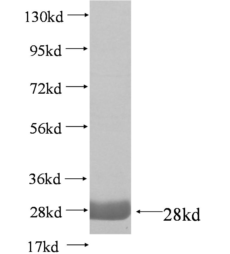 FOSB fusion protein Ag4209 SDS-PAGE FOSB fusion protein Ag4209 SDS-PAGE
