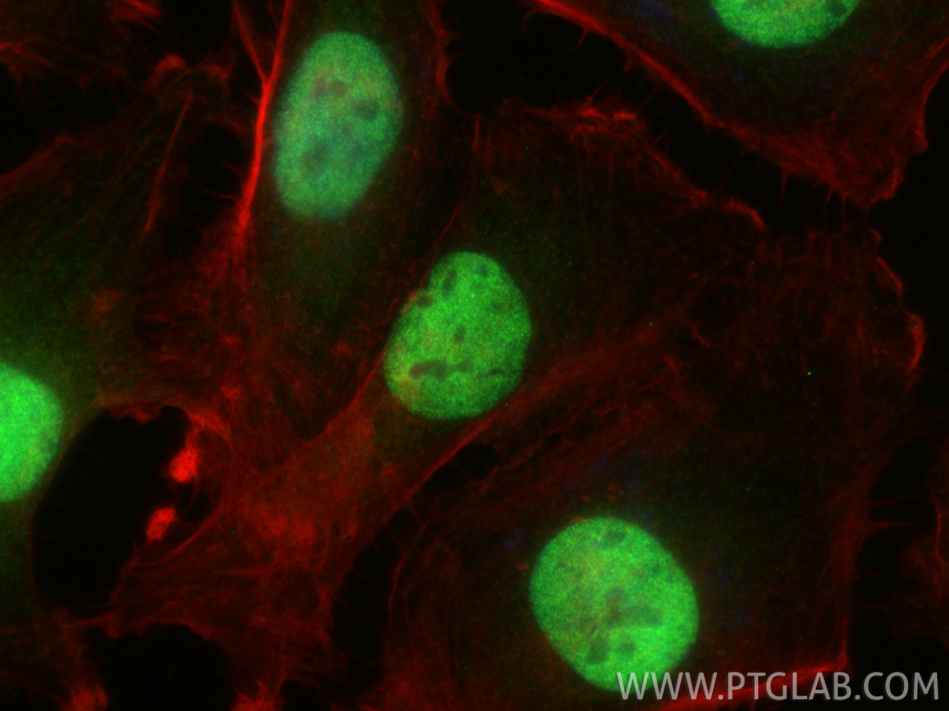 IF Staining of U-251 using 12663-1-AP