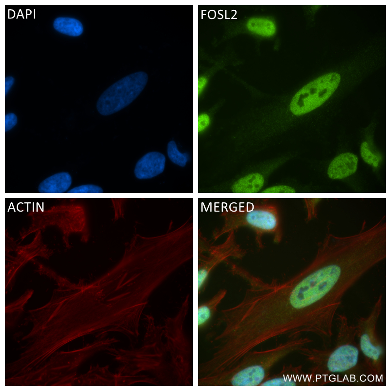 IF Staining of HeLa using 84718-5-RR