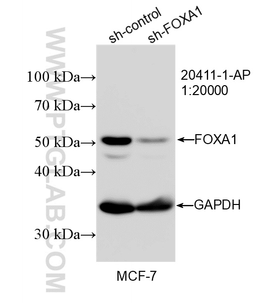 WB analysis of MCF-7 using 20411-1-AP WB analysis of MCF-7 using 20411-1-AP