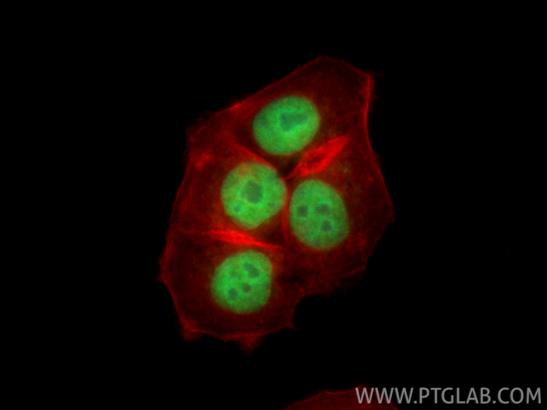 IF Staining of MCF-7 using CL488-85125-6 IF Staining of MCF-7 using CL488-85125-6