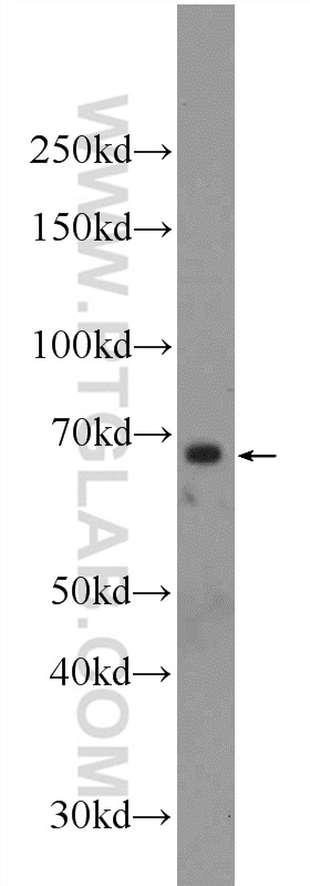 FOXA2 Polyclonal antibody