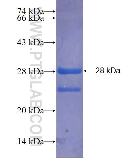 FOXA3 fusion protein Ag14503 SDS-PAGE FOXA3 fusion protein Ag14503 SDS-PAGE