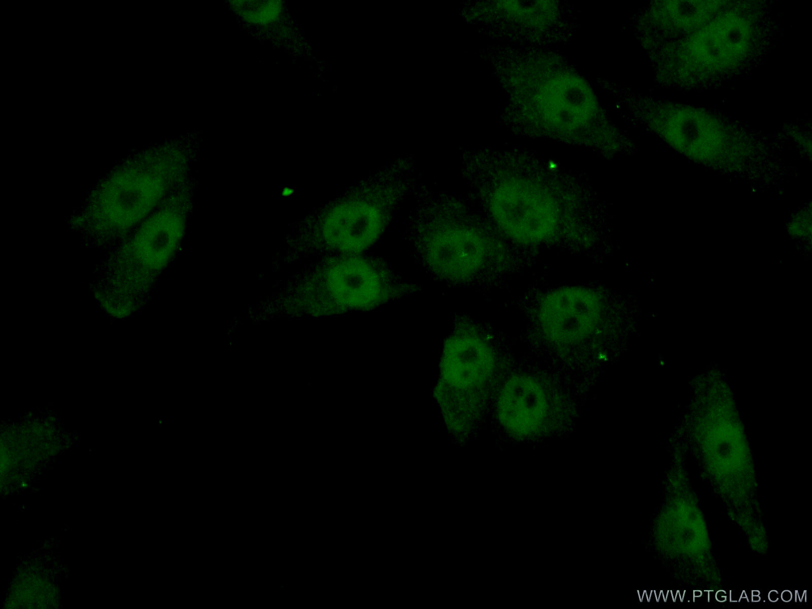 IF Staining of A375 using 23066-1-AP