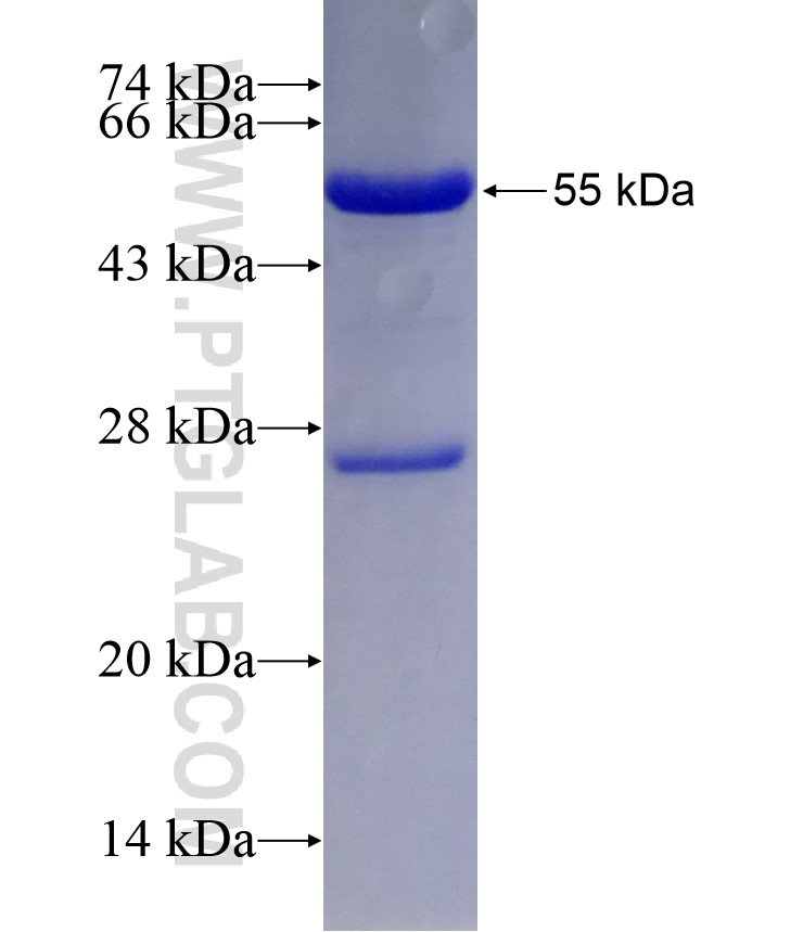 FOXD1 fusion protein Ag29344 SDS-PAGE